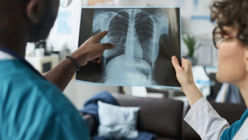 Une révolution silencieuse bouleverse l'oncologie pulmonaire. Tandis que les campagnes anti-tabac portent leurs fruits à travers le monde, une menace inattendue émerge : le cancer du poumon chez les non-fumeurs connaît une progression alarmante, particulièrement en Asie orientale.